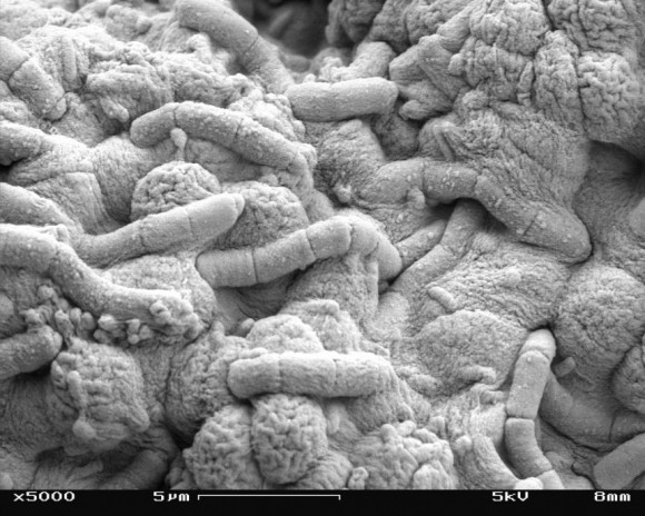 Vi khuẩn dưới kính hiển vi